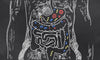 Is Gut Bacteria the Solution for Optimum Health?